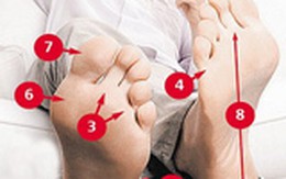 Vết chai chân có phải dấu hiệu của bệnh tật?